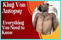 King Von Autopsy Photo: An Insight Into The Life And Legacy Of A Rising Star